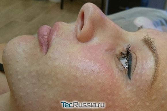 1498303364_biorevitalization-2